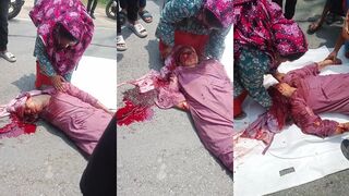 When your head slams into the pavement