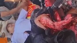 Time To Sell A Moped And Buy A Wheelchair