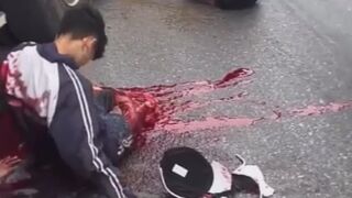 Moped Rider Gets Ripped In Halves