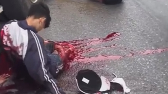 Moped Rider Gets Ripped In Halves