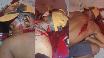 Homeless Man Hacked To Death With Machete And Left To Bleed Next To Chupa Chups