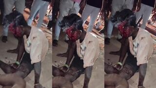 Mans Face Destroyed Following Traffic Accident