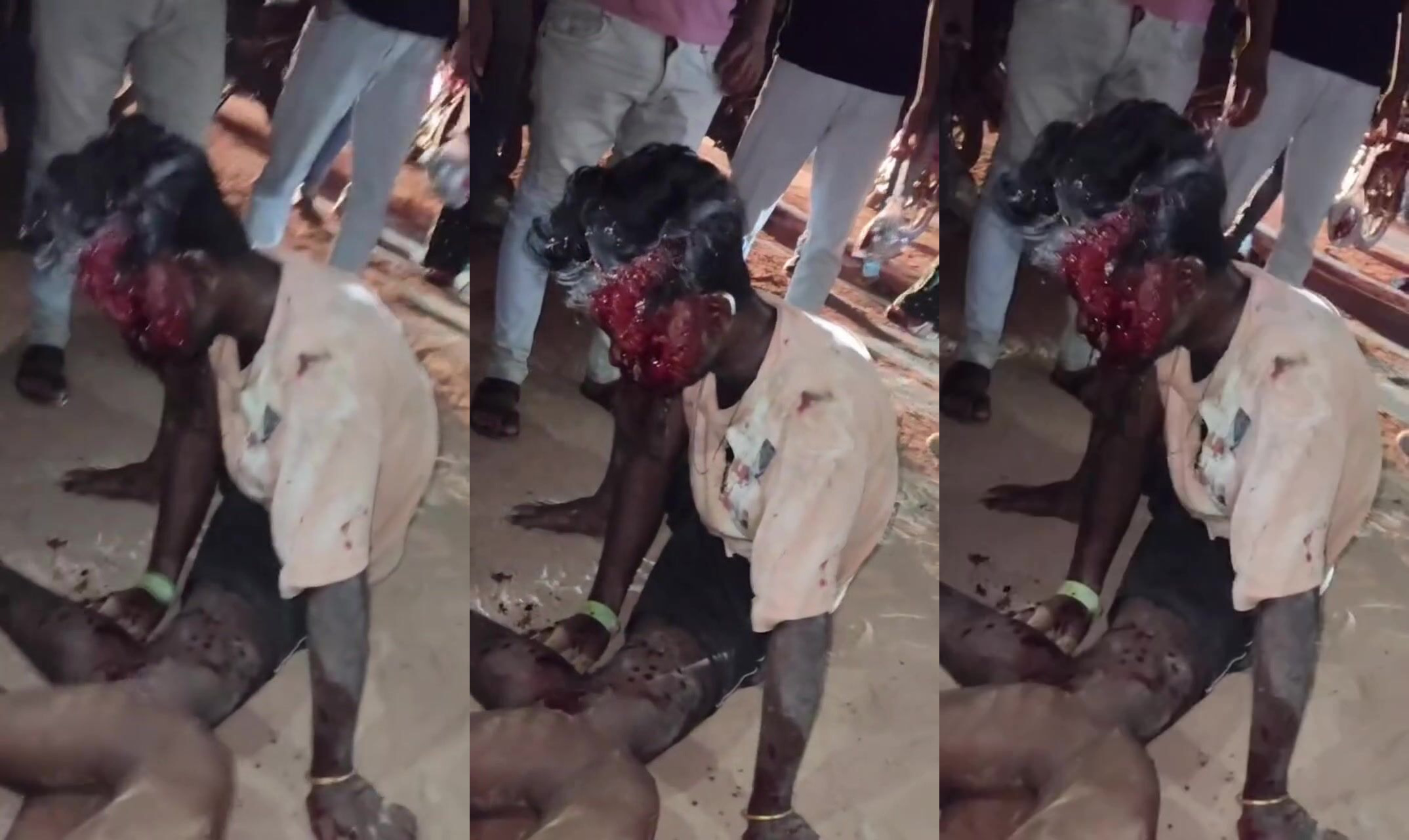 Mans Face Destroyed Following Traffic Accident