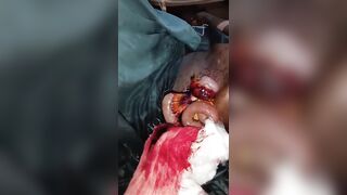 OG Stabbed During Robbery In Enugu State