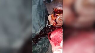 OG Stabbed During Robbery In Enugu State