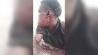 Man Shot In Mouth Survives Yesterday`s Massacre Of Christains By Boko Haram