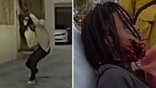 Man Wielding BB Gun and Knife Shot by LAPD Officers After Charging at Them