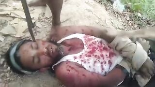 Kidnapped and tortured for ransom
