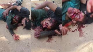 victim of machete attack