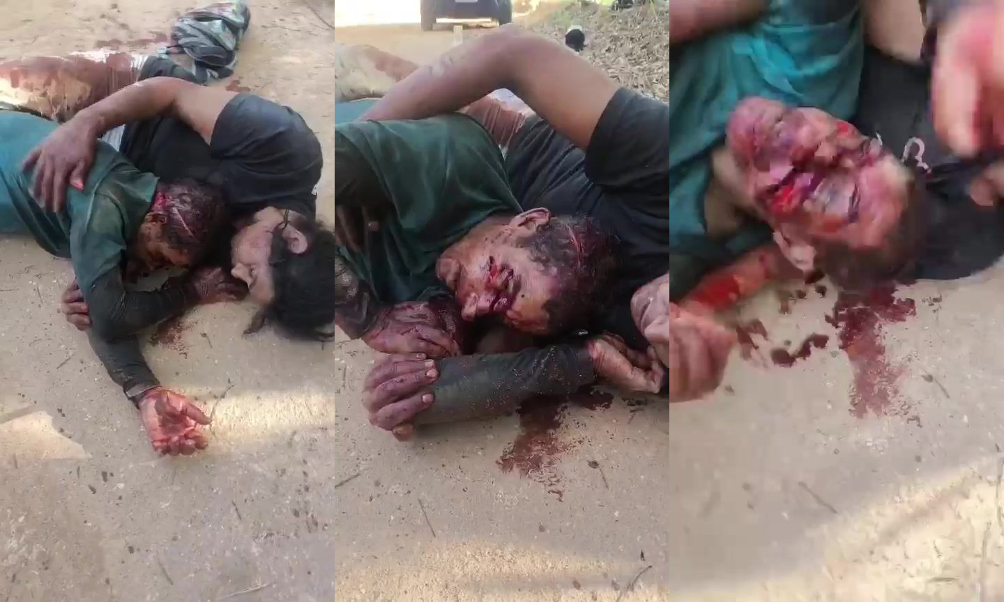 victim of machete attack