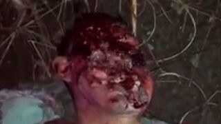 Motorcyclist with Deflated, Flattened Face in Extreme Agony – Still Alive