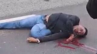 Motorcyclist Bleeding From Mouth After Falling On Road Head First