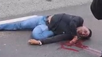 Motorcyclist Bleeding From Mouth After Falling On Road Head First
