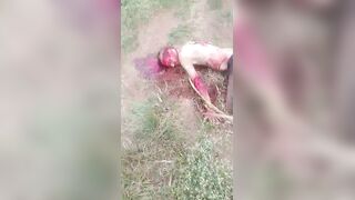 Brutal Machete Attack Survivor