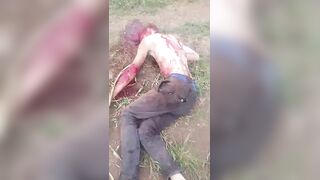 Brutal Machete Attack Survivor