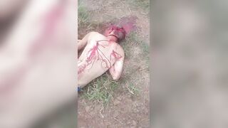 Brutal Machete Attack Survivor