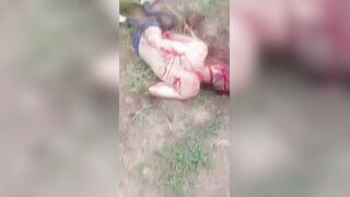 Brutal Machete Attack Survivor