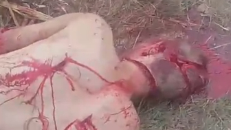Brutal Machete Attack Survivor