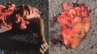 Man Destroyed By Hit And Run Driver