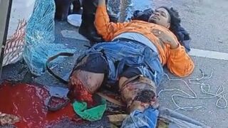 Truck Driver Lost Both Legs In Traffic Accident