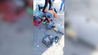 Truck Driver Lost Both Legs In Traffic Accident