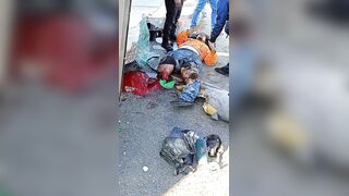Truck Driver Lost Both Legs In Traffic Accident
