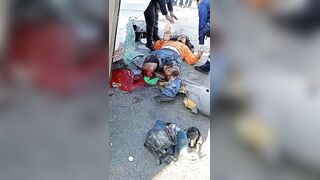 Truck Driver Lost Both Legs In Traffic Accident