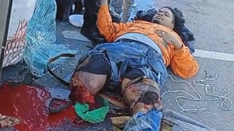 Truck Driver Lost Both Legs In Traffic Accident