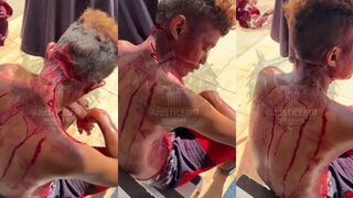 Dude Almost Beheaded By Machete