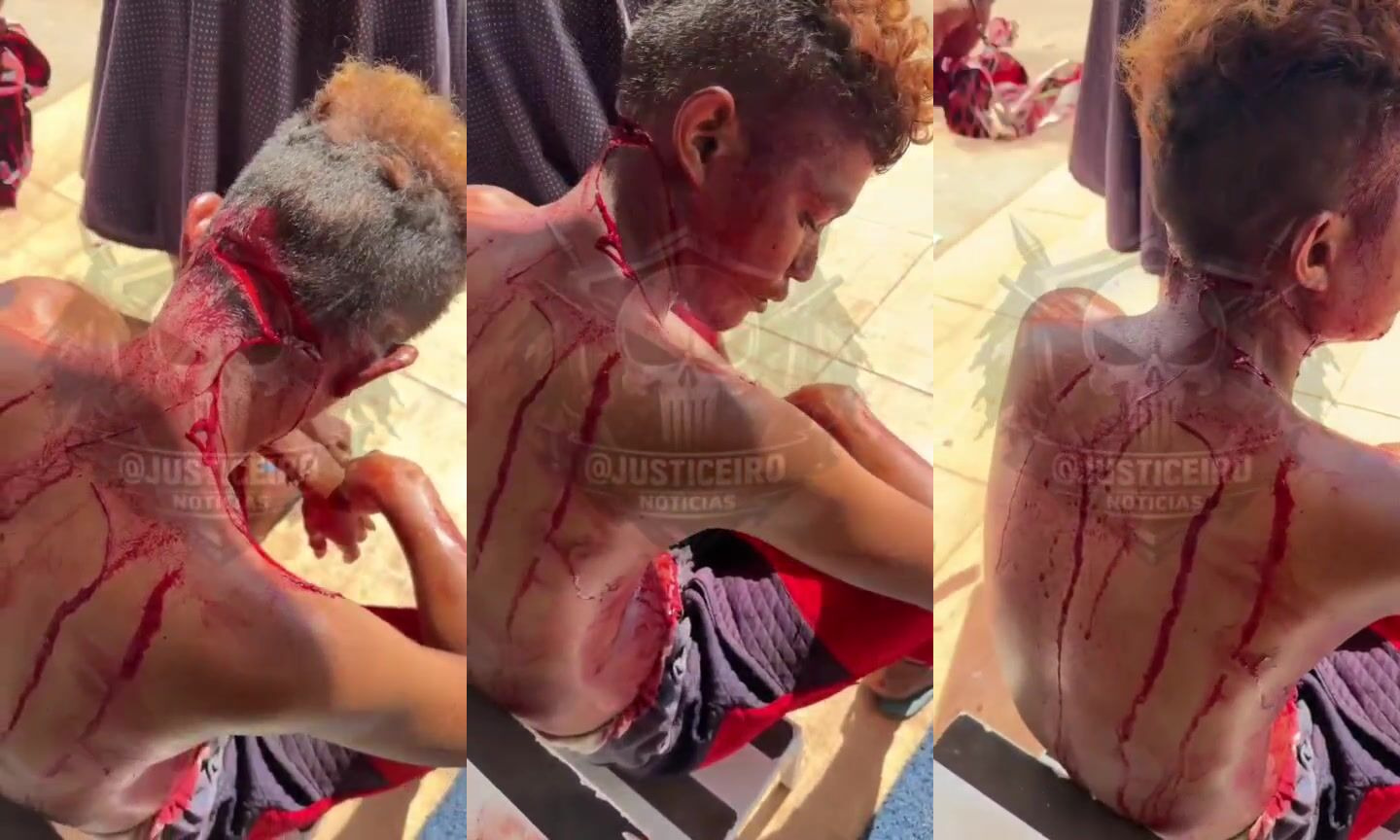 Dude Almost Beheaded By Machete
