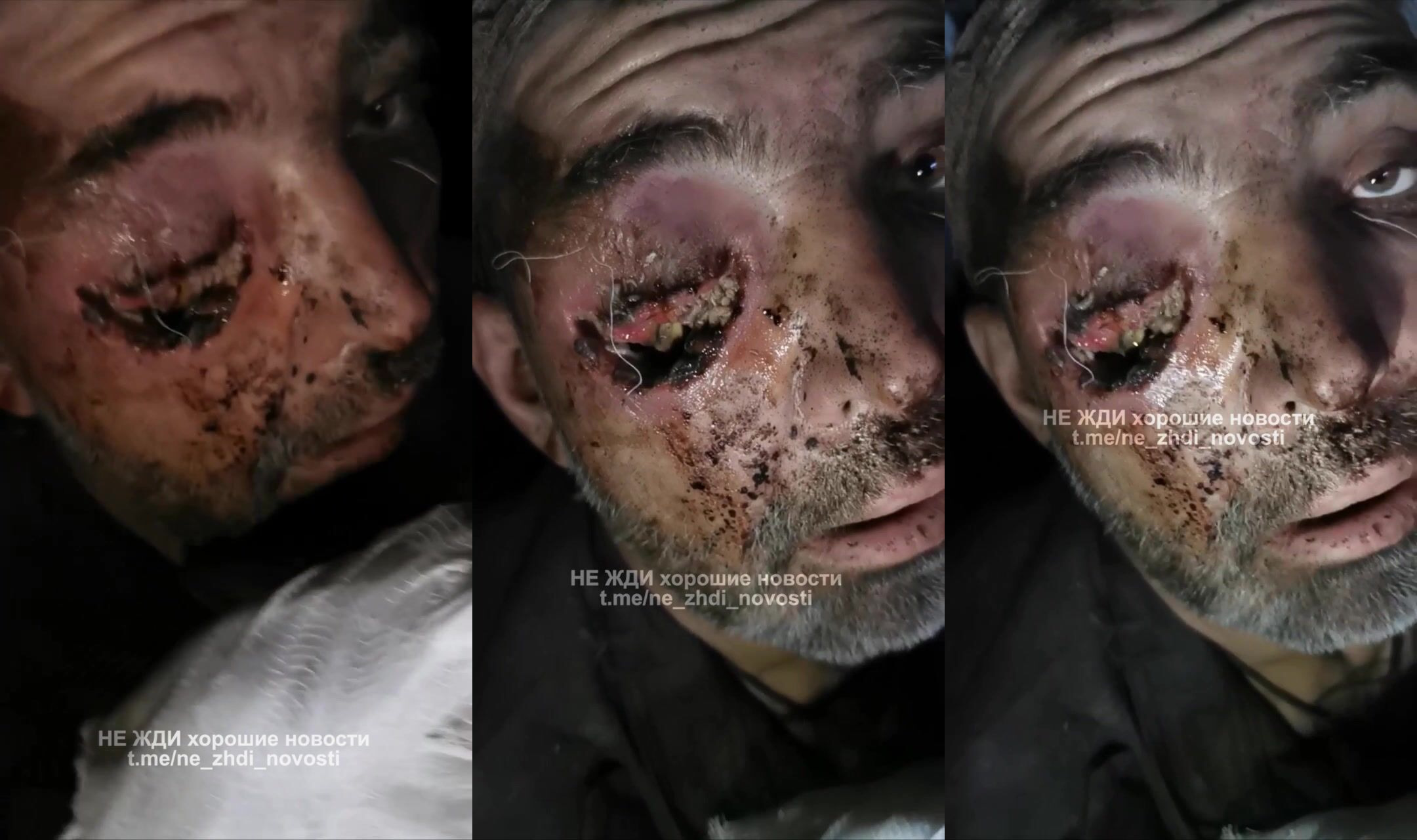 russian got fucked in the right eye
