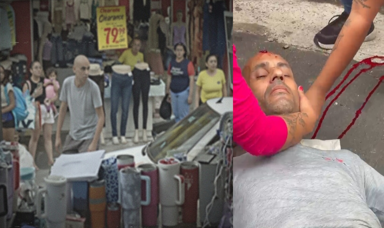 Bystander Shot in Head After Blocking Jewelry Store Robbery Escape