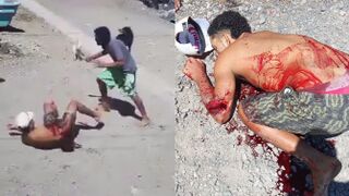 Man Gets Fatally Stabbed During Fight In Costa Rica