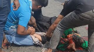 How This Poor Woman Is Still Alive