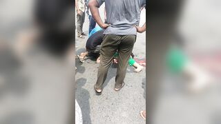 How This Poor Woman Is Still Alive