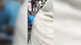How This Poor Woman Is Still Alive