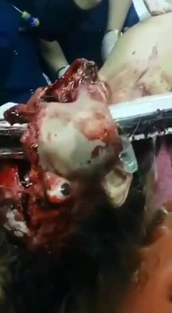 Classic gore compilation