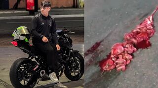 Motorcyclist Literally Split in Half After Devastating Crash