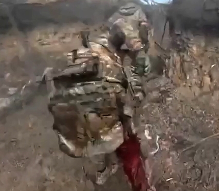 Ordinary day, wounded Orc