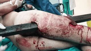 Medical aftermath compilation