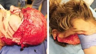 Medical aftermath compilation