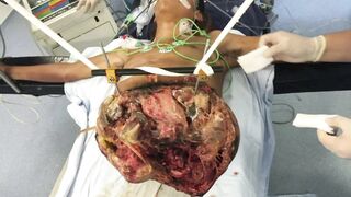 Medical aftermath compilation
