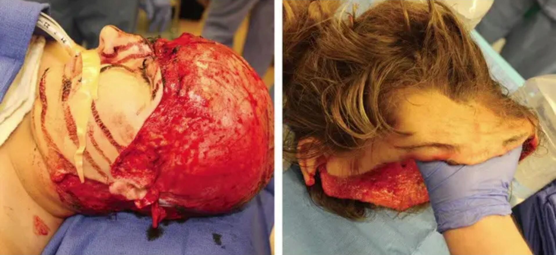 Medical aftermath compilation
