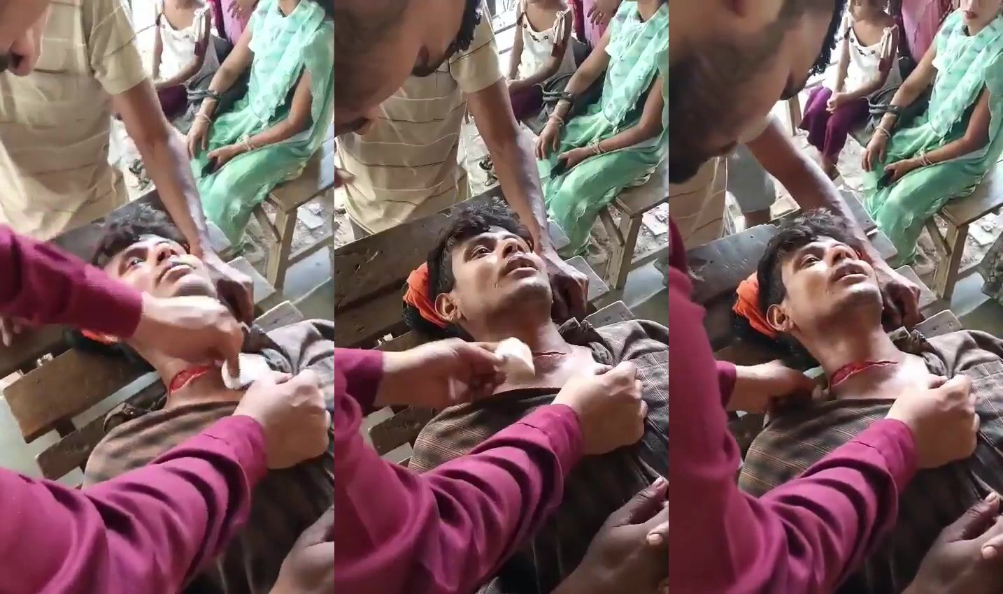 An Indian man was cut by his wife in his sleep