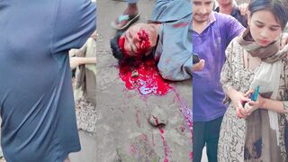 One dead after head strike in accident