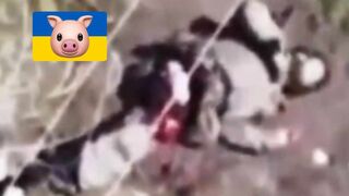 Drone mangles Ukrat leg.