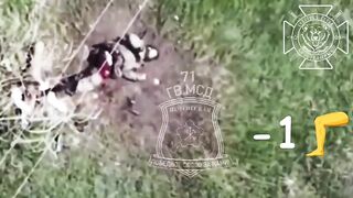 Drone mangles Ukrat leg.