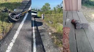 Loses leg in bike vs car