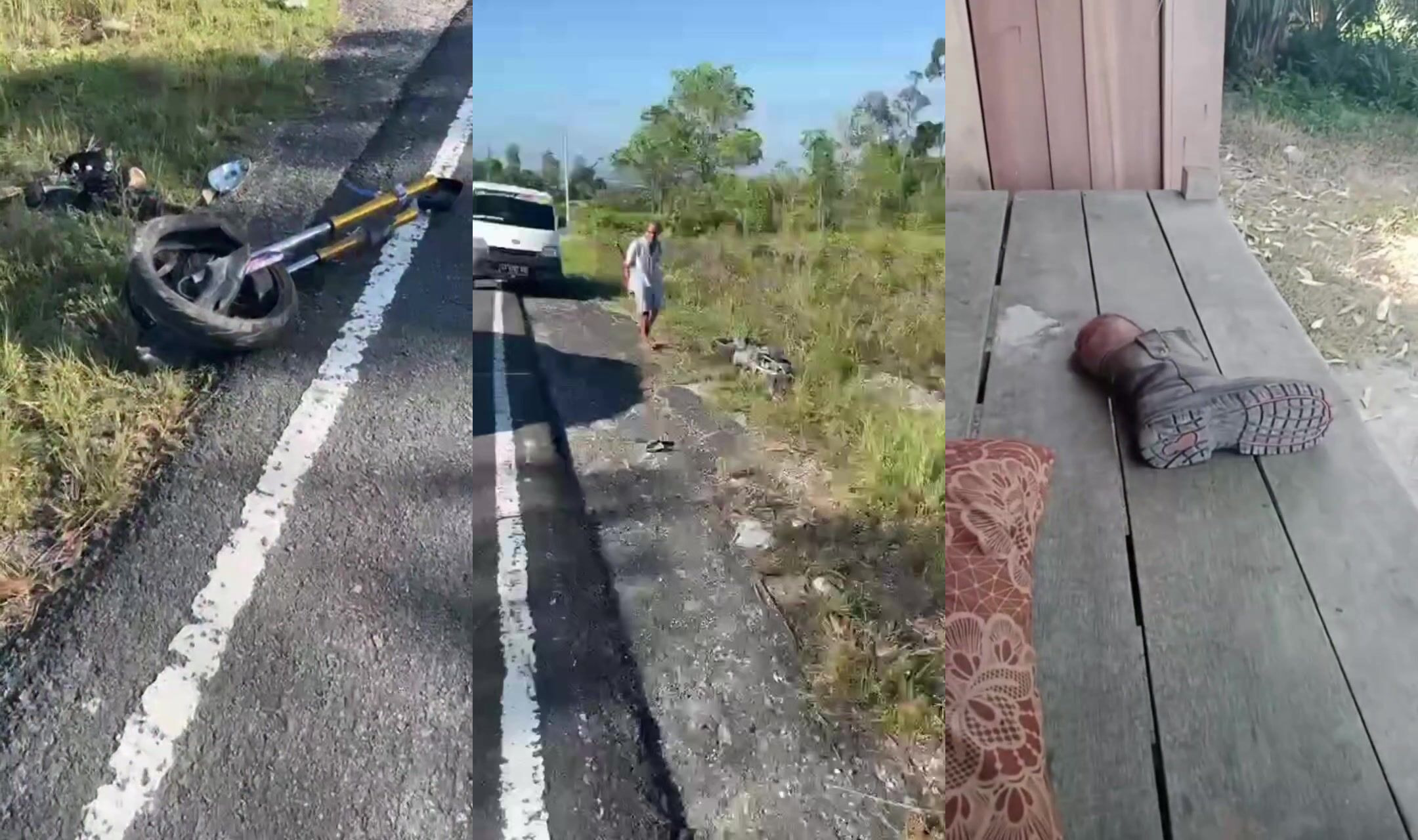 Loses leg in bike vs car