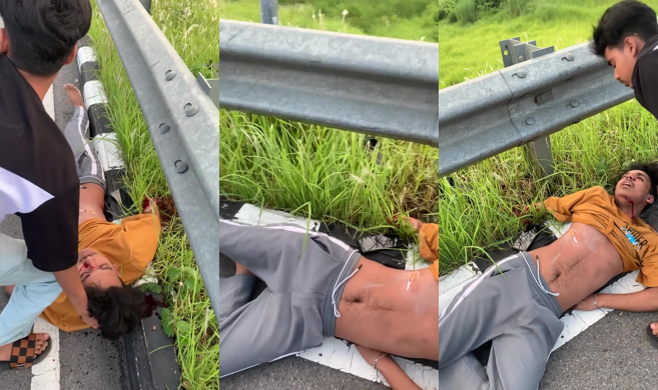 Man has seizure after losing arm in accident